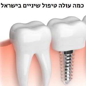 כוללים טיפול שיניים במרפאת השיניים