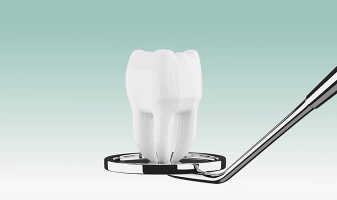 מהו תהליך טיפול שיניים בהרדמה כללית